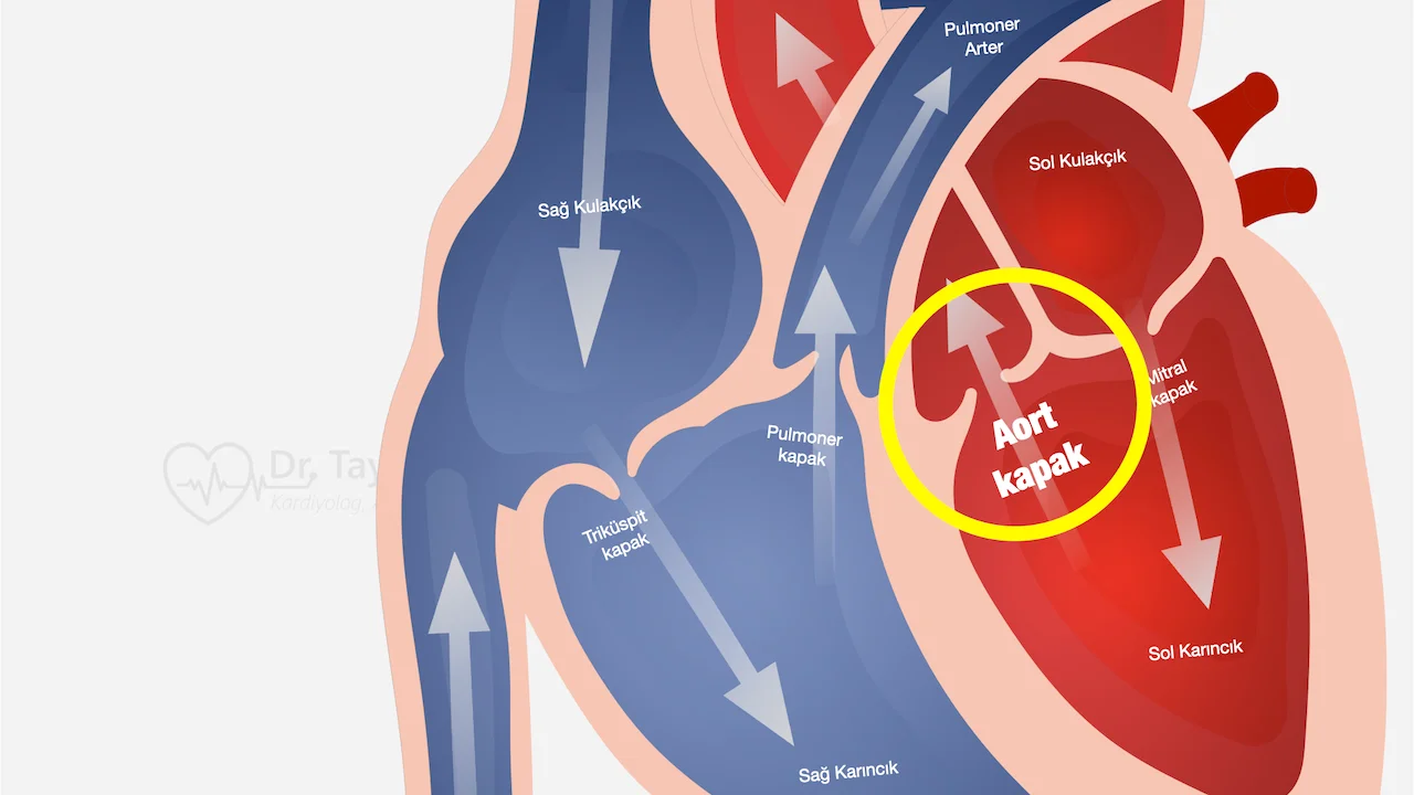 aort-kapak-hastaligi